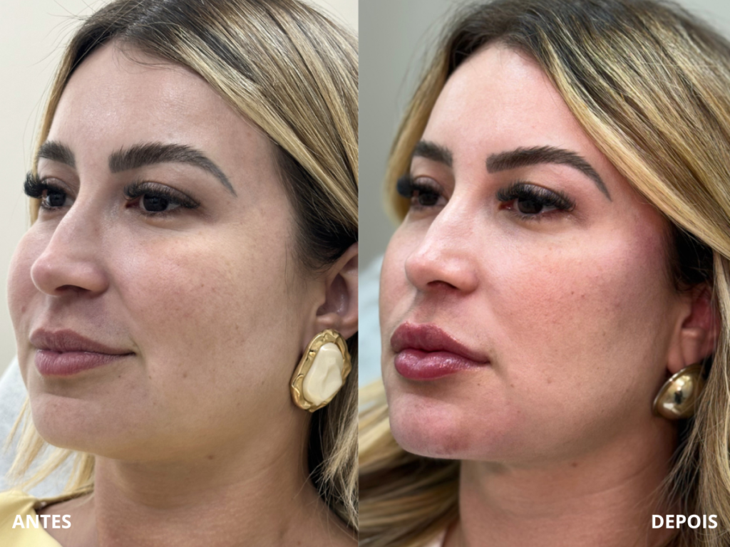 Resultado de paciente — ReFace
